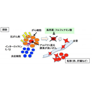 風邪薬の成分「フルフェナム酸」が膀胱がんの転移を抑制 - 北大