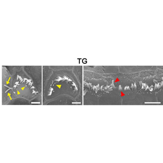 神戸大など、遺伝性感音難聴の原因遺伝子変異を同定 - 聴毛などに異常
