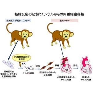 信州大など、カニクイザルでiPS心筋細胞の同種移植に成功 - 心臓機能が回復