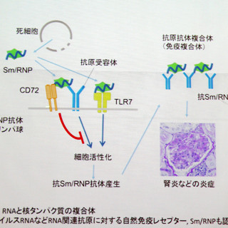 TMDU、自己免疫疾患「エリテマトーデス」の発症を抑制するメカニズムを解明