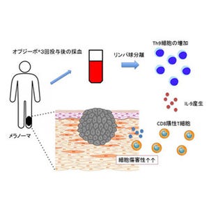 がん免疫療法の新薬「オプジーボ」が効果を発揮するメカニズム - 京大