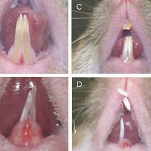 歯のエナメル質はどのように作られるのか - 東北大がマスター遺伝子を同定