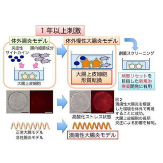 東京医科歯科大、潰瘍性大腸炎の体外モデル作成に成功