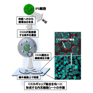 遺伝性難聴の原因となる内耳細胞をiPS細胞から作製 - 順天堂大