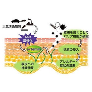 大気汚染物質がアトピー性皮膚炎の症状を引き起こす - 東北大が仕組み解明