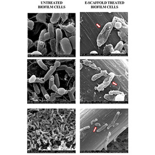 弱い電流を流して薬剤耐性菌を殺傷する感染症治療法 - ワシントン州立大