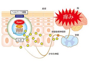 九大、アトピー性皮膚炎のかゆみを起こすタンパク質を発見-作用機所も解明