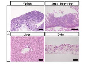 京大、iPS技術でがん関連遺伝子の働きを変えることが可能であることを確認