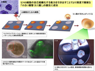 NCCHD、ES細胞から機能的なミニ腸を創り出すことに成功