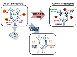 Aβオリゴマーの除去でアルツハイマー症の病態が回復する可能性 - NCNP