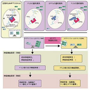 名大、認知症の一種「前頭側頭葉変性症」の発症メカニズムを解明