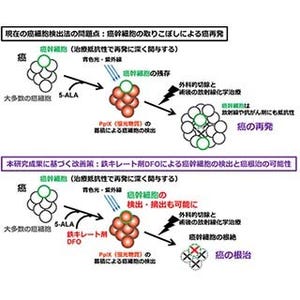 がん幹細胞は光線力学診断薬による検出を免れる特性がある - TMDUと東工大