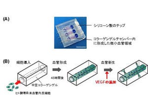 東大、血管新生の3次元構造の変化をライブ観察することに成功