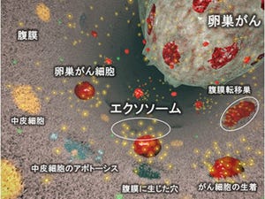 国がん、卵巣がんの治療を困難にする腹膜播種性転移のメカニズムを解明