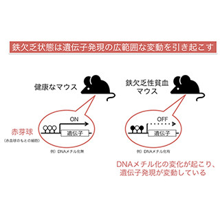 鉄欠乏性貧血は単なる鉄の不足により起こるわけではない - 東北大と九大