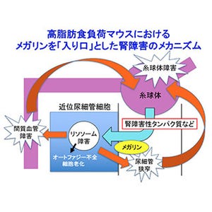 糖尿病性腎症の成因に基づく尿検査法を開発 - 新潟大学