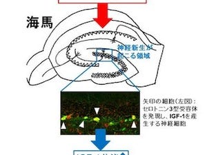 阪大、SSRIによる抗うつ作用とは異なる、新しいうつ病治療メカニズムを発見