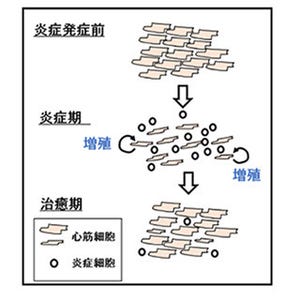 心筋に秘められた再生能力を発見 大阪大グループ