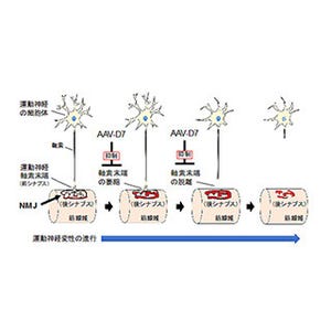 神経筋接合部の形成増強によりALSモデルマウスの病態が改善、延命 - 東大