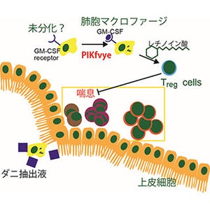 肺胞マクロファージ分化に必須の酵素を発見 - 喘息の抑制に重要な役割