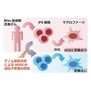 京大CiRA、患者由来iPS細胞とゲノム編集技術でBlau症候群の疾患モデルを構築