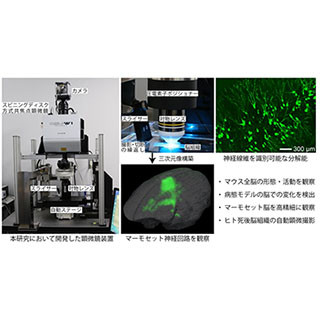 阪大、脳全体を高速・高精細に観察できるイメージング装置を開発