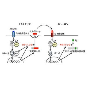 カテプシンBが歯周病によるアルツハイマー様病態に関与する - 九大