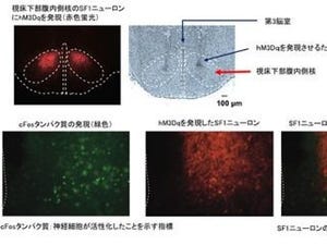 肥満の病因解明に期待 - 食欲を抑え、糖利用を促進するニューロン発見