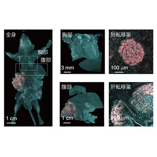 マウス透明化で1細胞レベルのがん微小転移を解析できる技術 - 東大