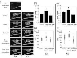 名大、保険適応の医療材料を用いた温熱刺激が骨形成を促進することを実証