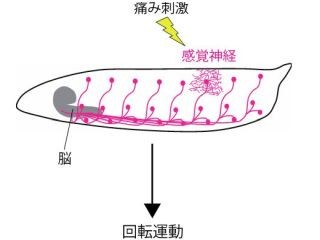 東大、痛みを感じると逃げたくなる「仕組み」を解明