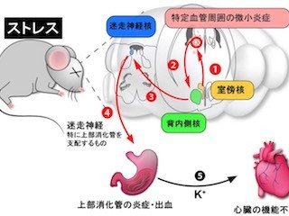 北大、「病は気から」の分子メカニズムを解明-ストレス性疾患の根本治療へ