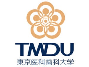 TMDU、日本人に多い上大静脈起源の心房細動の遺伝的リスク因子を同定