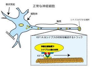 東北大学、シナプスの位置を特定する因子を発見