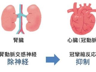 狭心症や心筋梗塞の治療法を改善、腎臓から心臓を治療する - 東北大学