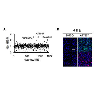 京大、ヒトES/iPS細胞由来の膵前駆細胞を増殖促進する低分子化合物を同定