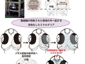 放射線治療予後や脳機能障害の改善に - メダカ胚にモデル利用の可能性