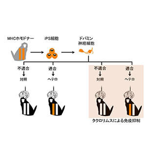 京大CiRA、iPS細胞由来神経細胞の他家移植におけるMHC適合の有用性を確認