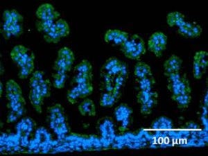 未熟児の自閉症発症を抑制できる可能性-腸でのオキシトシン吸収機構を発見