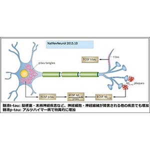 アルツハイマー病の血液診断法 - 京都府立医大がp-tau定量システムを開発