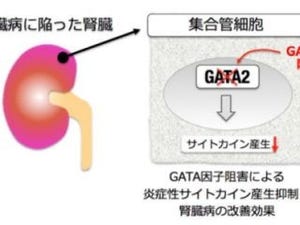 東北大、抗がん剤が腎臓病の症状改善に有効であることを発見