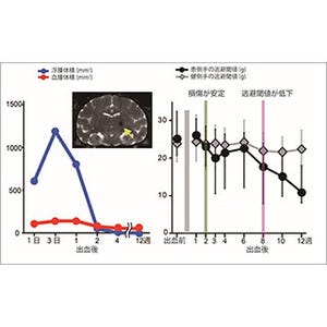 産総研、脳卒中後に生じる痛みを解明し治療するためのモデル動物を確立