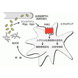 九大、歯周病菌の出す酵素がアルツハイマー病型認知症の悪化に関与と解明