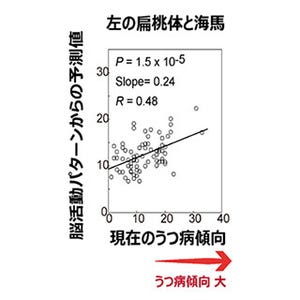 経済的不平等に対する脳活動パターンが、1年後のうつ病傾向を予測