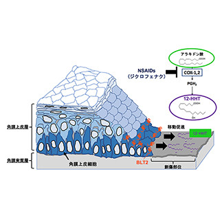 順天堂大、角膜上皮障害の修復メカニズム解明-角膜潰瘍の新規治療薬へ期待