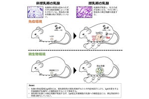 乳腺炎ワクチン開発へ一歩-授乳期の免疫・微生物環境を解明