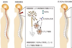 京大、脊髄損傷後に一度失われた指の器用さ回復- サルで抗体治療に成功