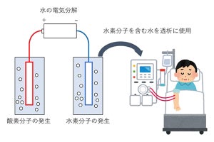 東北大、慢性透析患者の生存期間を改善する電解水を用いた透析システム開発