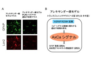 難治性神経変性疾患「アレキサンダー病」の原因分子を発見