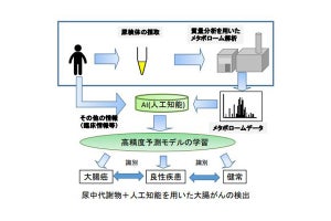 AIで尿中の代謝物を解析することで大腸がんを高精度検出